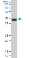 HOXD3 Antibody (clone 1B12)