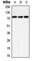 Polyclonal Rabbit anti-Human PTPN11 / SHP-2 / NS1 Antibody (phospho-Tyr542, IHC, WB)