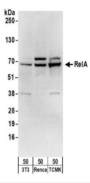 RELA / NFKB p65 Antibody (aa501-551)