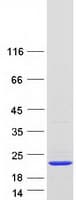 Human UBE2I / UBC9 Protein (Recombinant Myc-DDK (Flag))