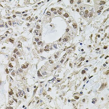 SET / TAF-I Antibody
