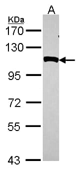 IHC-plus™ NPEPPS Antibody (aa328-648)