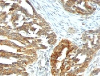 VEGFA / VEGF Antibody (clone VEGF/1063)