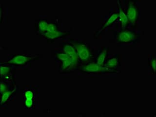 Polyclonal Rabbit anti-Human COPS7B / CSN7B Antibody