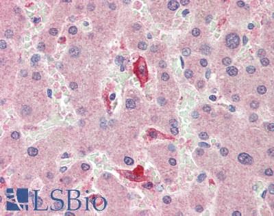IL18BP Antibody