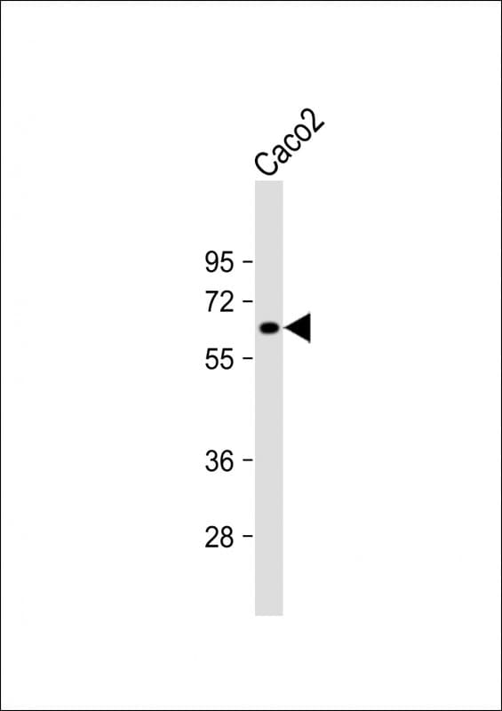ME1 / Malate Dehydrogenase Antibody (N-Terminus)