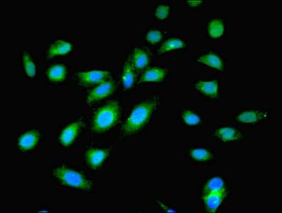 Polyclonal Rabbit anti-Human OGT / O-GLCNAC Antibody (aa606-1022, IHC)