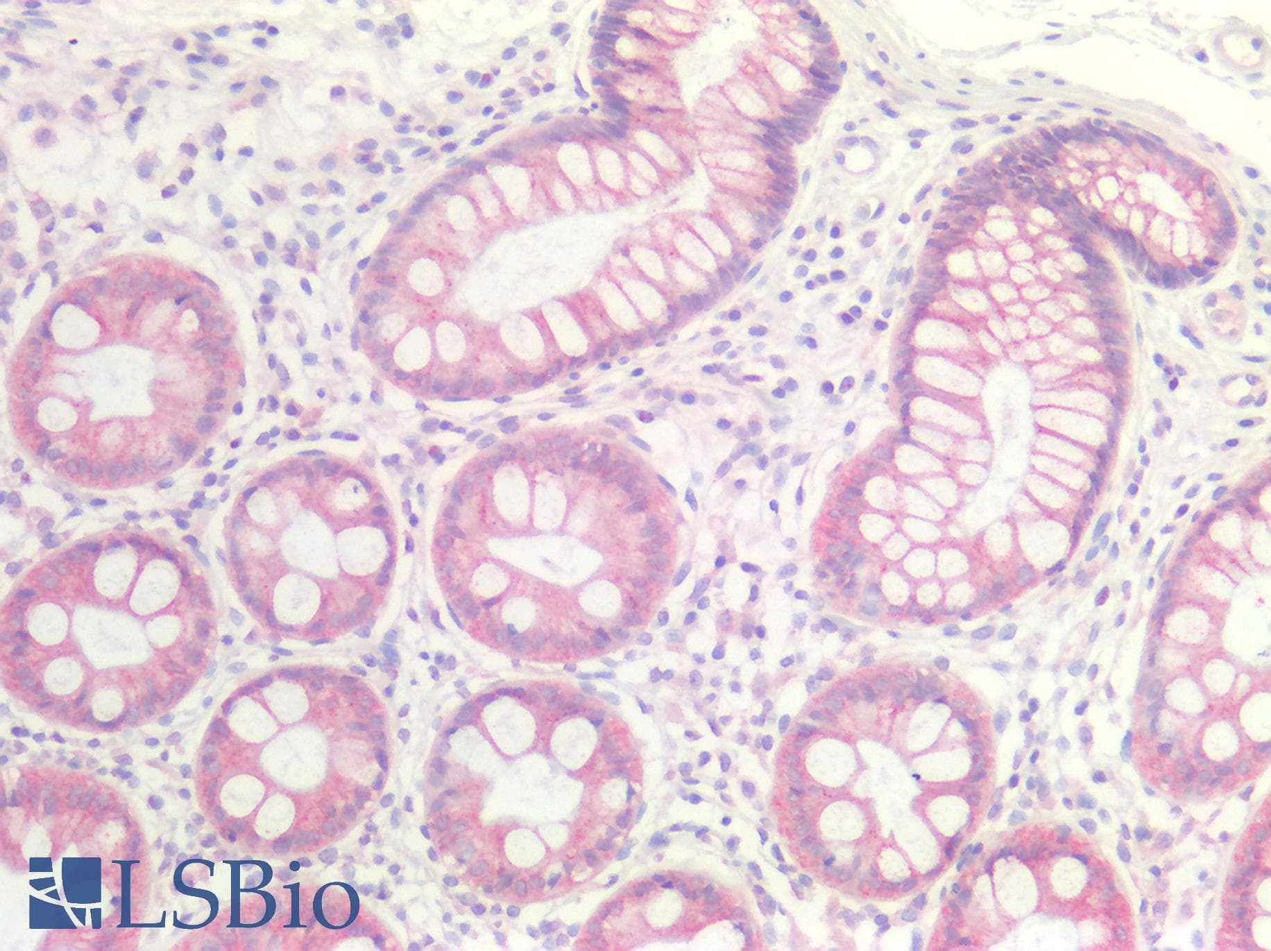PathPlus™ GDF15 Antibody