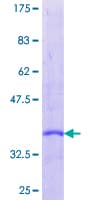Human Secretin Protein (Recombinant GST)