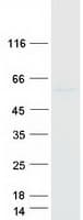 Human BBS4 Protein (Recombinant Myc-DDK (Flag))