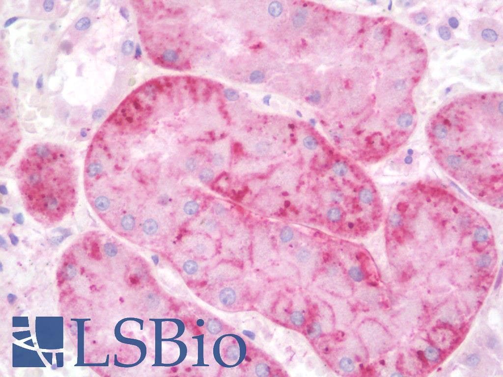 IHC-plus™ GRK6 Antibody