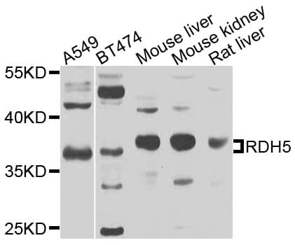 Polyclonal Rabbit anti-Human RDH1 / RDH5 Antibody (IHC, WB)