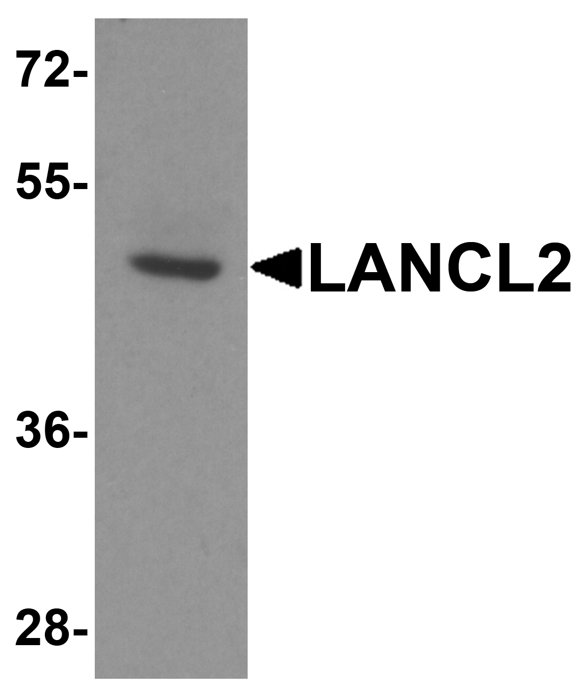 IHC-plus™ TASP / LANCL2 Antibody