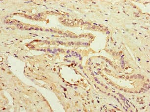 PRDX2 / Peroxiredoxin 2 Antibody