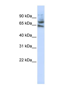 MCTP1 Antibody (aa468-517)
