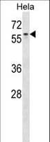 Polyclonal Rabbit anti-Human AGFG1 Antibody (aa1-30, WB)