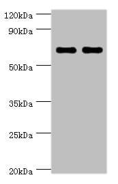 BIRC2 / cIAP1 Antibody (aa1-300)