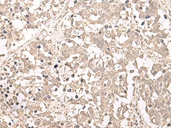 Polyclonal Rabbit anti-Human RRP1 Antibody (IHC, WB)