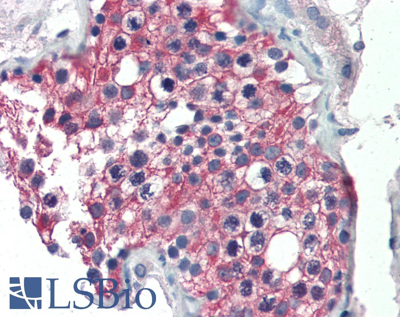 IHC-plus™ ALDH1A1 / ALDH1 Antibody (aa476-488)