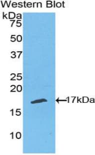 TNFRSF19L / RELT Antibody (aa222-363)