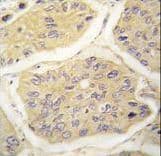 B2M / Beta 2 Microglobulin Antibody (aa8-39)