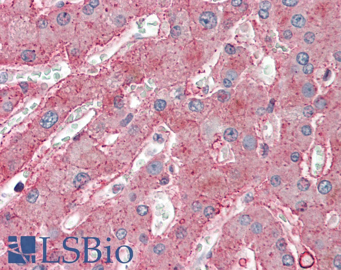 Polyclonal Rabbit anti-Mouse ANXA6/Annexin A6/Annexin VI Antibody (aa501-550, IHC, WB)
