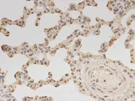 Polyclonal Rabbit anti-Human ZEB1 / AREB6 Antibody (IHC, IF, WB)
