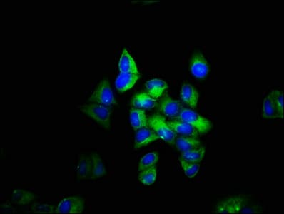 Polyclonal Rabbit anti-Human TLN1 / Talin 1 Antibody (aa92-399, WB)