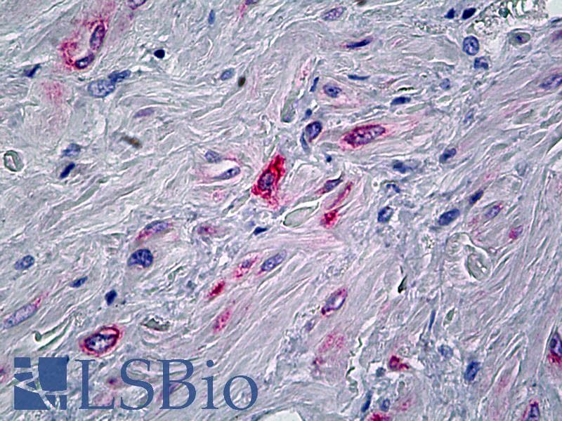 IHC-plus™ Polyclonal Rabbit anti-Human PPP1R13L / iASPP Antibody (aa75-125, IHC, WB)