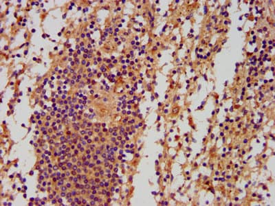 Polyclonal Rabbit anti-Human PNPLA5 Antibody (IHC, IF, WB)