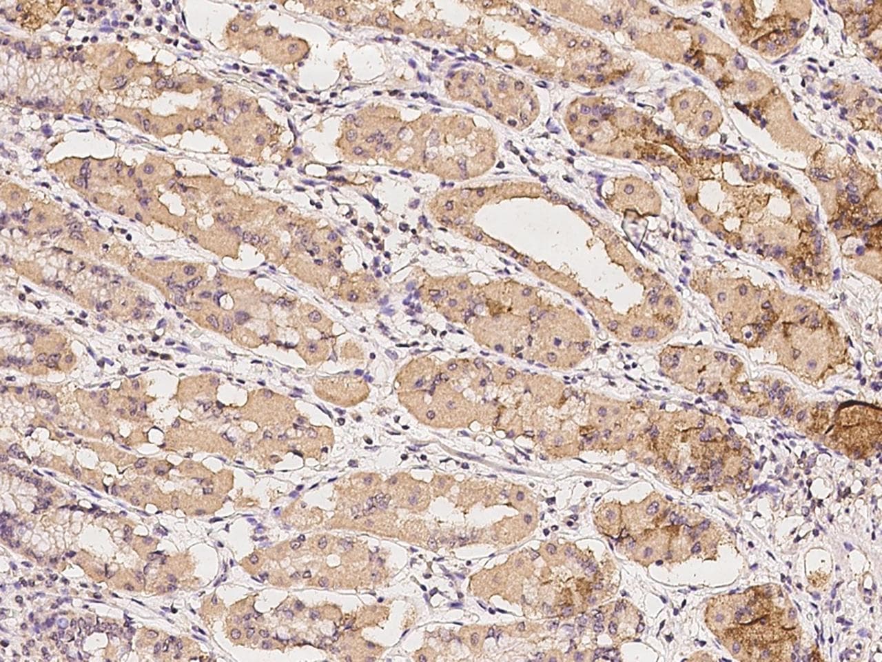 NUTF2 / PP15 Antibody