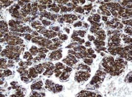 HSD17B8 / RING2 Antibody (aa57-261, clone OTI2E12)