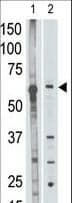 Polyclonal Rabbit anti-Human MMP25 / Leukolysin Antibody (aa470-499, WB)
