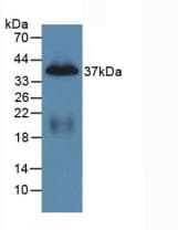 PPY / Pancreatic Polypeptide Antibody (aa31-97)