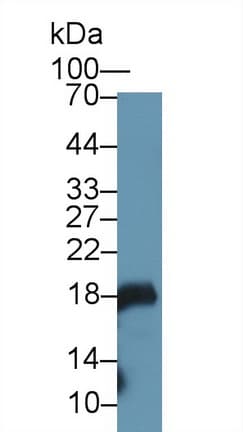 GKN1 / Gastrokine 1 Antibody (aa27-151)