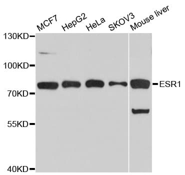 ER Alpha / Estrogen Receptor Antibody