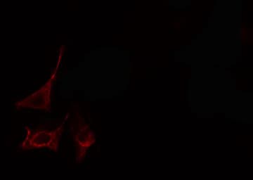 COL11A1 / Collagen XI Alpha 1 Antibody