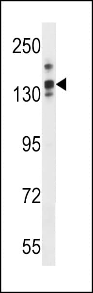 LRRC16 / CARMIL Antibody (aa1152-1178)