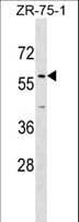 ZNF10 / KOX1 Antibody (aa118-148)
