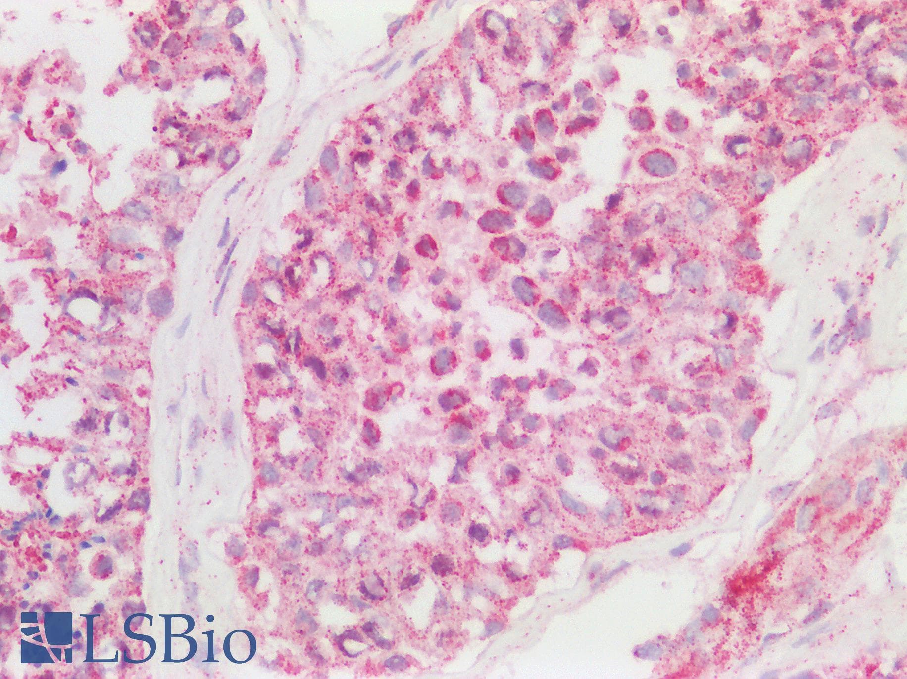 IHC-plus™ CNOT3 Antibody (aa525-575)