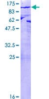Human MPP5 Protein (Recombinant GST)