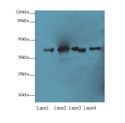 Polyclonal Rabbit anti-Human PPP2R4 Antibody (IHC, WB)