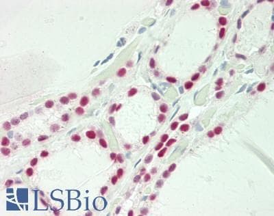 IHC-plus™ Monoclonal Mouse anti-Human PAX8 Antibody (clone 1F8-3A8, IHC, IF, WB)