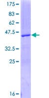 Human VEGFA / VEGF Protein (Recombinant GST)