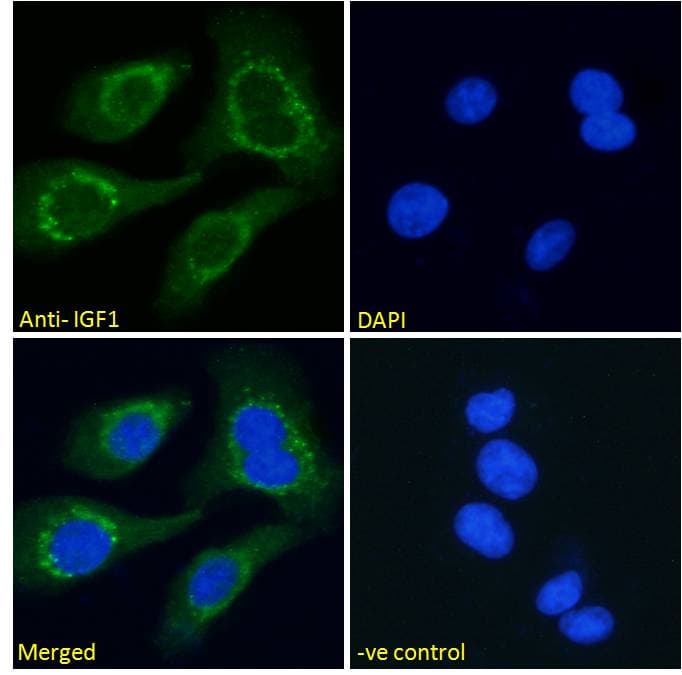 IHC-plus™ IGF1 Antibody (aa100-109)