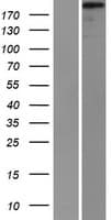 SVIL / Supervillin Protein (Over-Expression Lysate Myc-DDK (Flag))