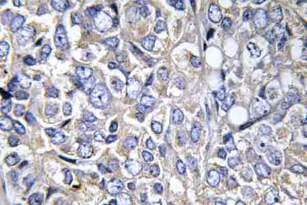 Polyclonal Rabbit anti-Human CTTN / Cortactin Antibody (phospho-Tyr421, IHC, WB)
