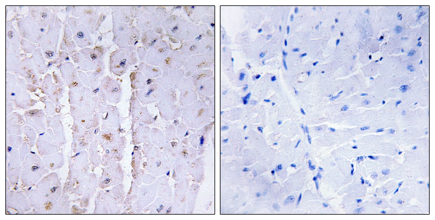 LBC / AKAP13 Antibody (aa721-770)