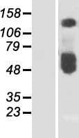 SLC30A1 / ZNT1 Protein (Over-Expression Lysate Myc-DDK (Flag))
