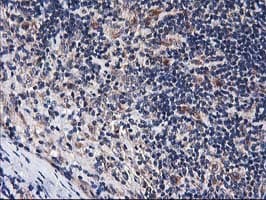HARS2 Antibody (clone OTI2D6)